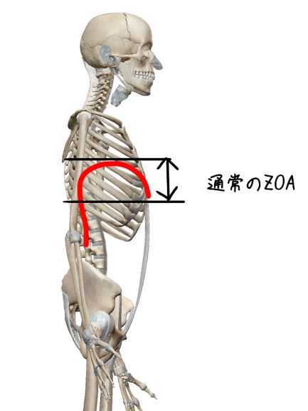肋骨とZOAの関係
