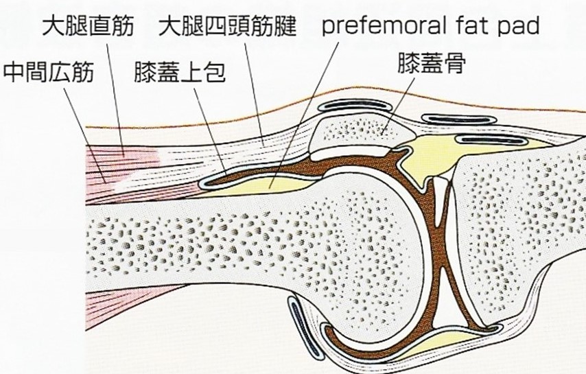 prefemoral fat pad の解説イラスト